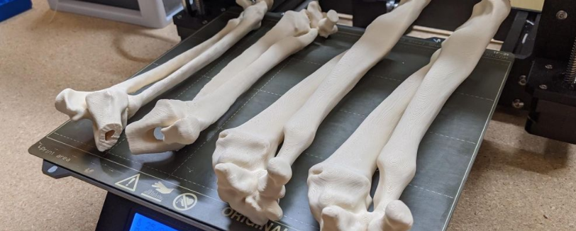 Disrupting Medical Education and Surgical Procedures with 3D Printing